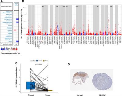 SLC13A4 Might Serve as a Prognostic Biomarker and be Correlated with Immune Infiltration into Head and Neck Squamous Cell Carcinoma